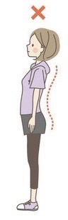 反り腰女性